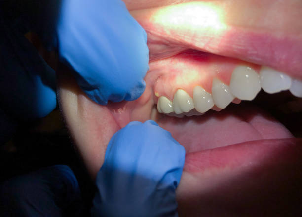 Best Emergency Tooth Extraction  in Stevensville, MT